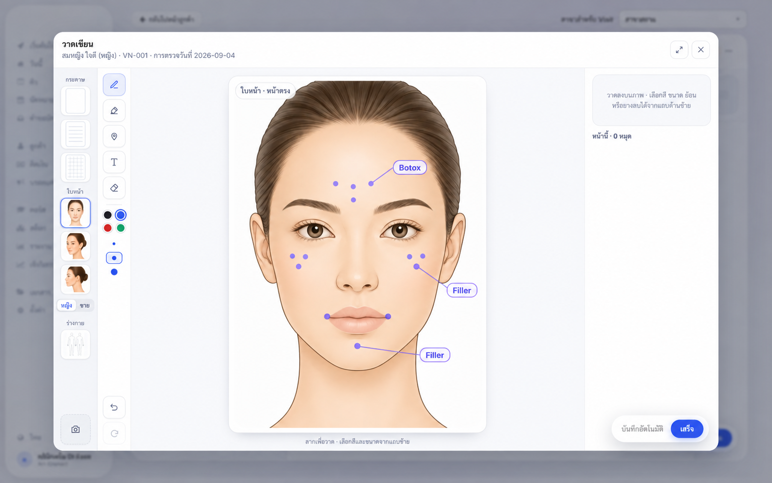 หน้าจอ Face Chart ของ Dr.Ease แสดงจุดระบุตำแหน่ง Botox และ Filler